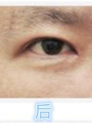 -美莱医学美容医院