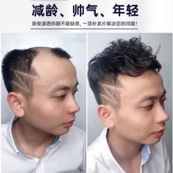 -发饰美男士增发补发假发定制店