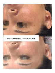 -MLP美丽派·问题肌疗愈中心