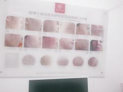 -痘博士烟台·全国连锁祛痘机构