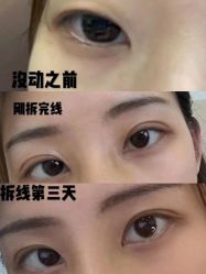 -成都西区医院整形美容