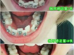 -团圆口腔·种植中心(锦江院区)