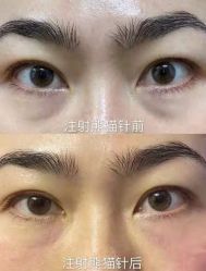 -上海漾颜医疗美容
