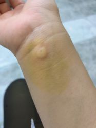 -More摩尔医美の注射线雕光电中心