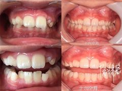 -Dr.Z dental仁康种植矫正中心