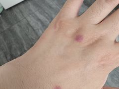 -黄海国家森林公园