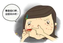 -蕾特恩·专业祛痘国际连锁