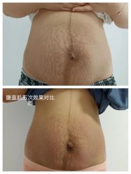 -骄阳兰多产后恢复&减龄中心(万科金域东郡店)