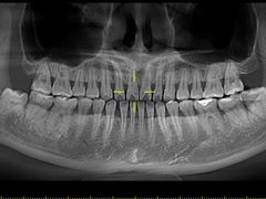 -Dr.Z dental仁康种植矫正中心