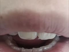 -极光口腔·矫正种植修复(锦江院区)