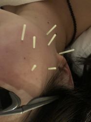 -肥三针腧穴瘦身馆