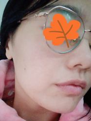 体验后-深圳阳光医疗美容医院·旗舰店