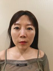 -万州华美紫馨整形美容医院
