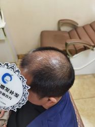 -唐风采假发补发定制