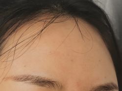 体验后-圣嘉新医疗美容医院