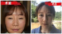 -素美医疗美容·西南眼鼻整形·修复基地