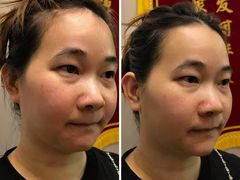 -修申骨雕小颜脊柱骨盆管理产后修复