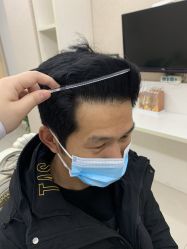 -大麦微针植发丨全国连锁