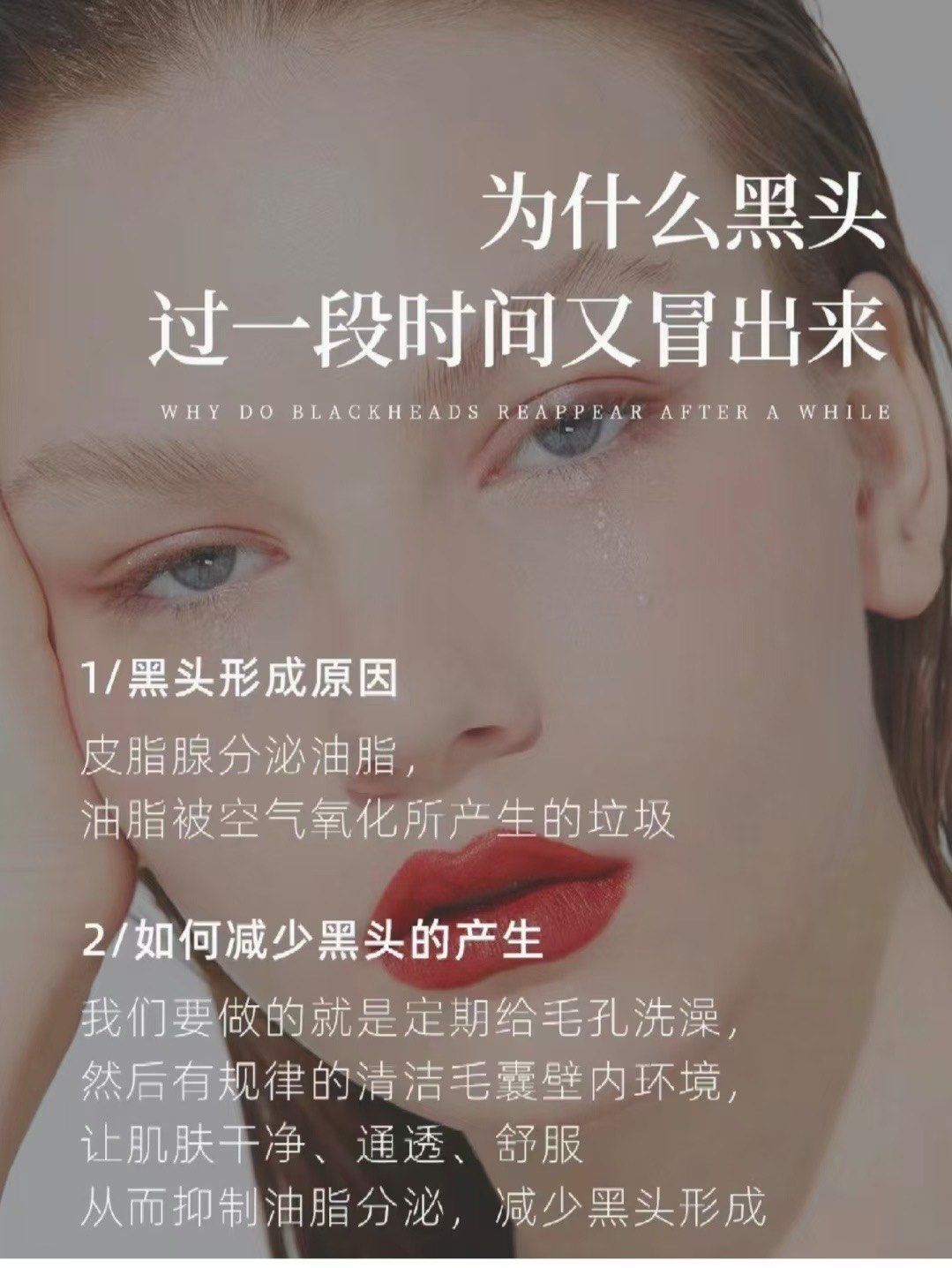 为什么有黑头怎么产生的百科在线