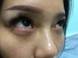 -痣清宫祛斑祛痣连锁店