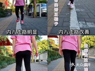 从小就要关注孩子足部健康啊