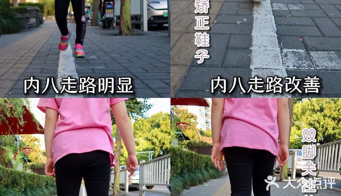 从小就要关注孩子足部健康啊🉐