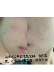 -La Rose·轻奢皮肤管理