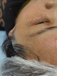 -长沙雅美医疗美容医院
