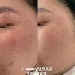 -E.beauty驻颜·痘敏肌调理中心