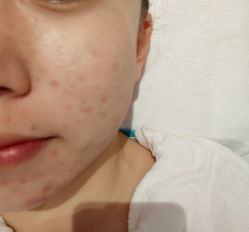 -禾壹净·素颜美问题肌肤修护中心