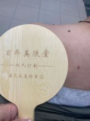 -百年美肤堂祛痦痣祛斑祛疣