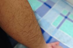 -薇兰专业脱毛连锁机构