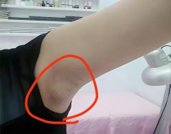 -丽减美瘦吧·减肥瘦身