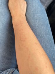 -明星刺青·洗纹身