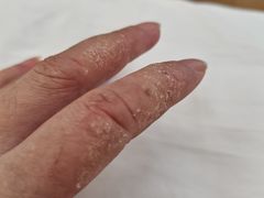 -新兴皮肤病专科门诊