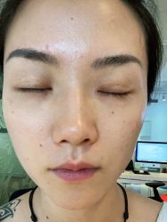 体验后-上海玫瑰医疗美容医院