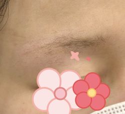 -张小野·专业半永久纹眉