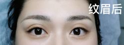 -MISS STAR·半永久纹眉·发际线·美瞳线