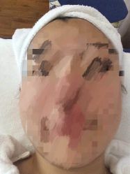 -宜肤清颜专业祛痘问题肌修护