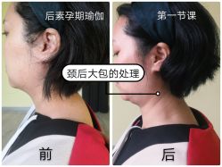-后素孕产瑜伽·运动康复中心