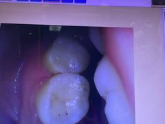 -深圳乐孚正强口腔诊所(宝体店)