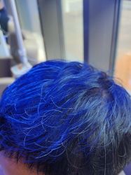 -碧莲盛·不剃发植发