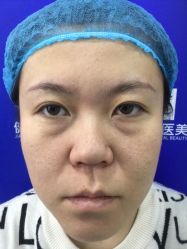 -天津健丽·去眼袋医疗美容机构