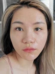-AiCure 埃可儿·韩国医学皮肤管理