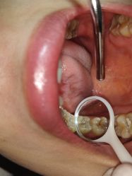 体验前-深圳春天阳光医院·轮廓抗衰中心