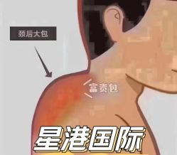 -星港国际·Skin皮肤专研·皮肤管理
