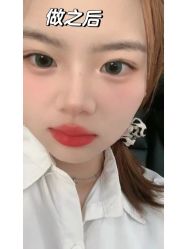 -上海伊莱美医疗美容医院