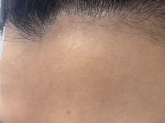 -大连市皮肤病医院