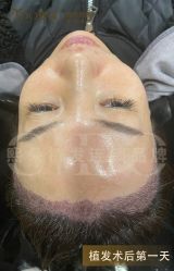 -熙朵美学植发·连锁品牌