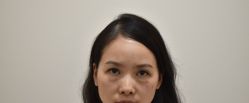 点击看大图 -广州健丽·去眼袋医疗美容机构